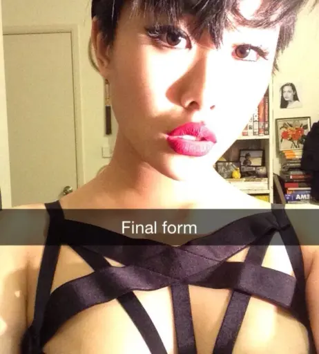 Image 11993115 from nickjonastillhasdiabetes