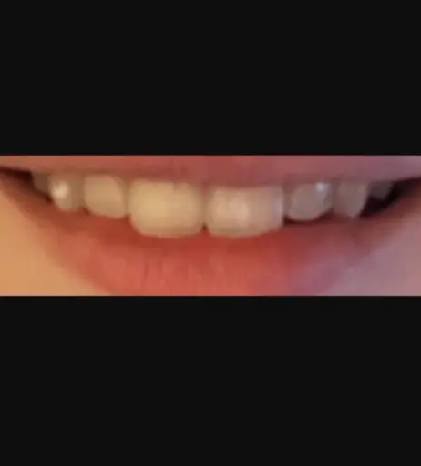 Image 11887144 from inislein