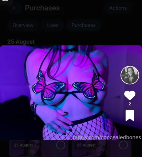 Image 12418661 from ConcealedBones