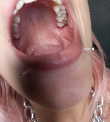 Image 12355158 from P3troleum