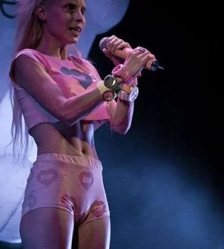 Image 12115516 from Yolandi Visser / Yo-landi Vi$$er