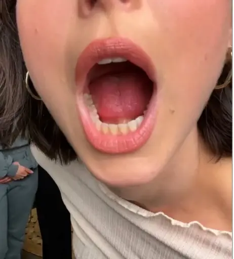 Image 1863415 from Lena Meyer-Landrut