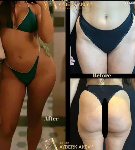 Image 1825268 from Jeje Lopes