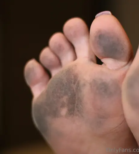 Image 18052608 from eurasian_feet