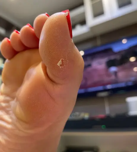 Image 18065240 from eurasian_feet