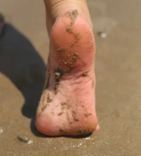 Image 18072798 from eurasian_feet