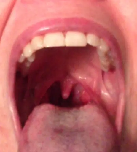 Image 19694795 from Megan Zass