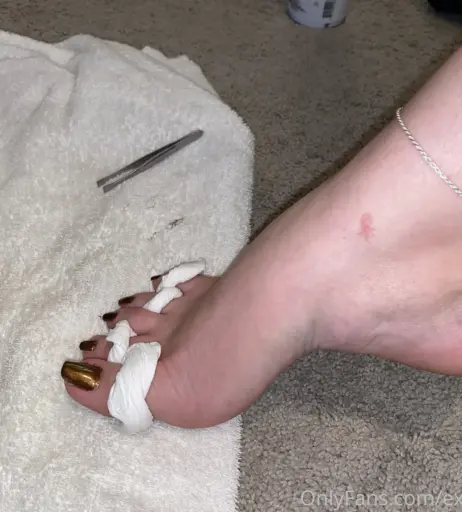 Image 17768064 from explosivetoess