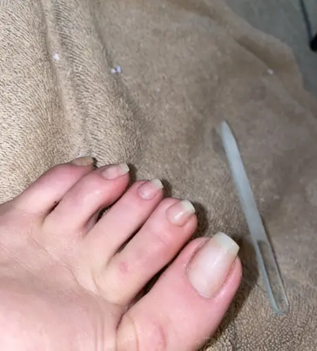 Image 17768210 from explosivetoess