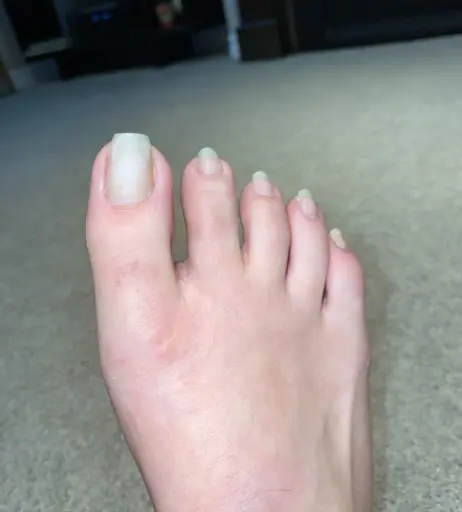 Image 17768214 from explosivetoess