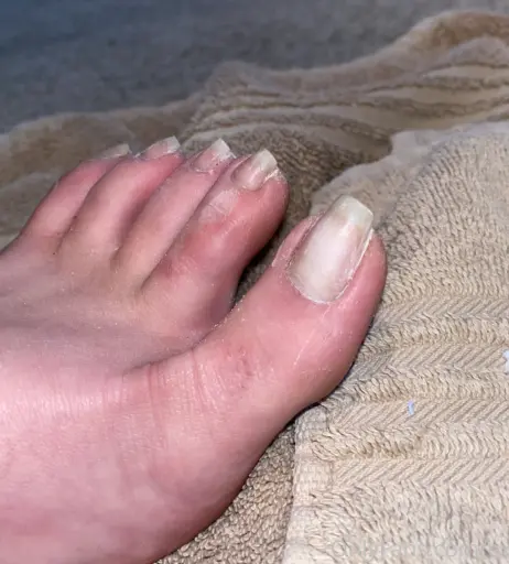 Image 17768218 from explosivetoess