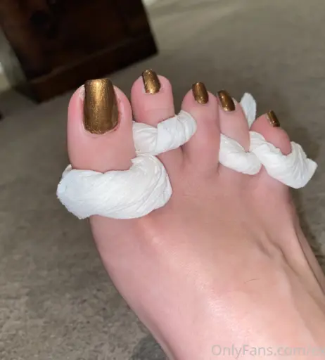 Image 17768255 from explosivetoess