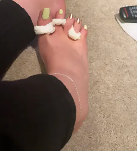 Image 17767655 from explosivetoess