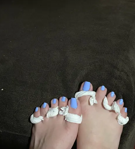 Image 17769292 from explosivetoess