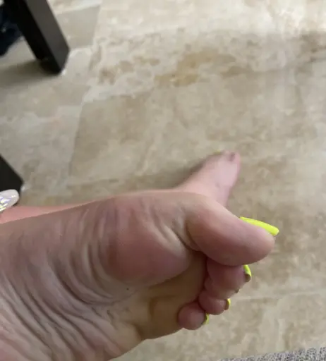 Image 17779224 from explosivetoess