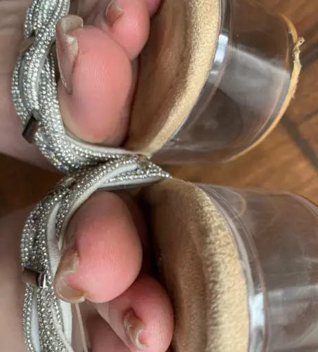 Image 17715927 from explosivetoess