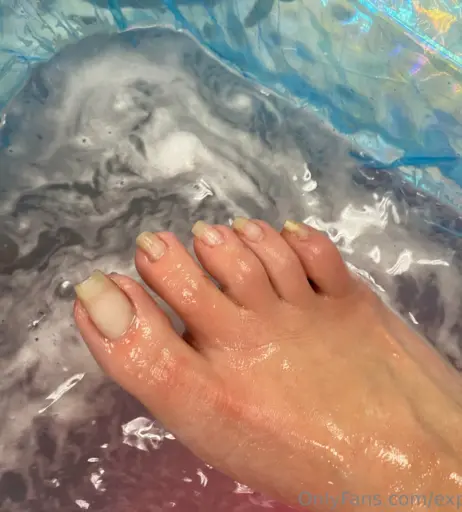 Image 17715861 from explosivetoess