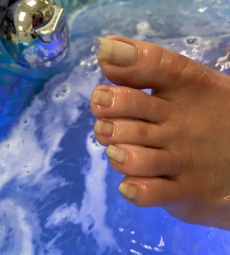 Image 17714702 from explosivetoess