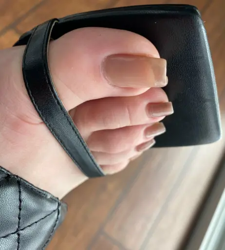 Image 17714769 from explosivetoess