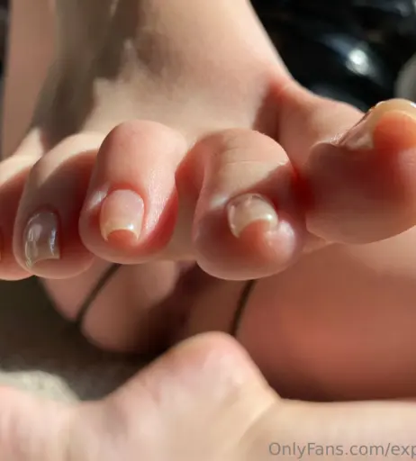 Image 17717415 from explosivetoess
