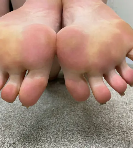 Image 17713687 from explosivetoess
