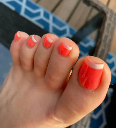 Image 17705847 from explosivetoess