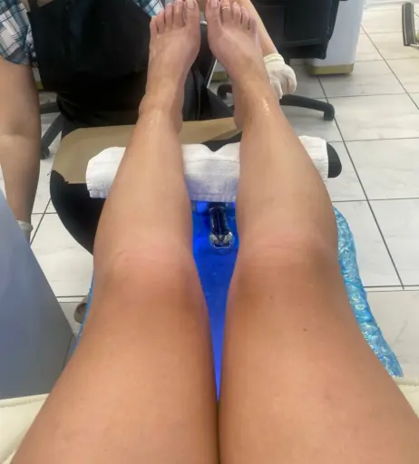 Image 17704309 from explosivetoess