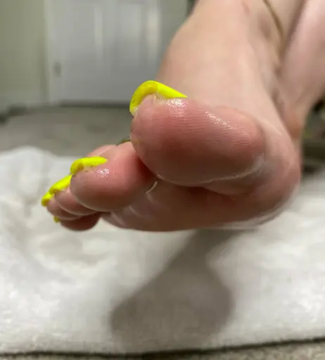 Image 17706633 from explosivetoess