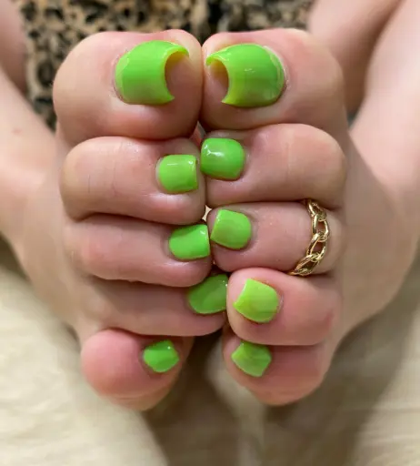 Image 17700405 from explosivetoess