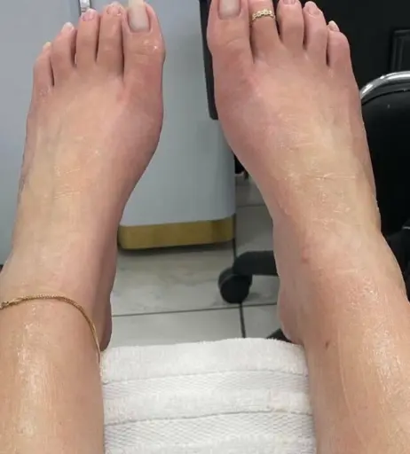 Image 17702284 from explosivetoess