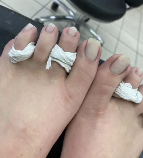 Image 17780727 from explosivetoess