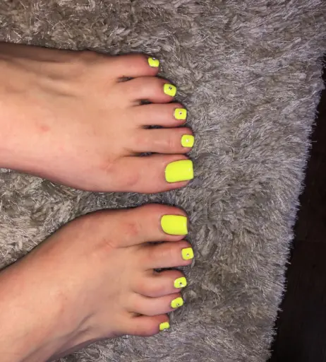 Image 17783195 from explosivetoess