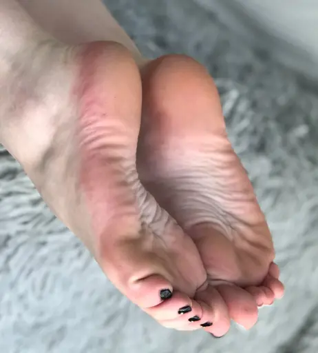 Image 17783124 from explosivetoess