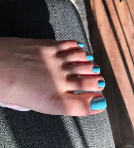 Image 17783109 from explosivetoess