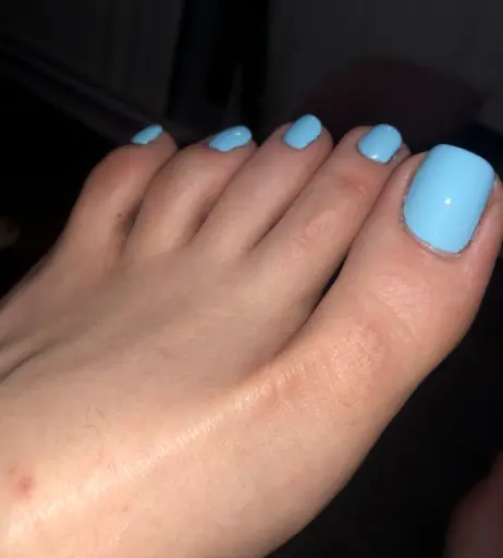 Image 17783264 from explosivetoess