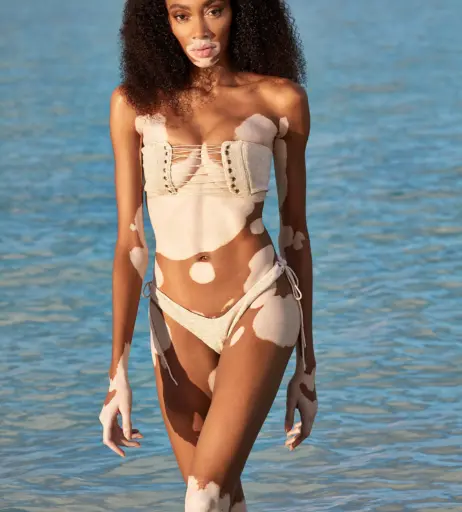 Image 1746893 from Winnie Harlow