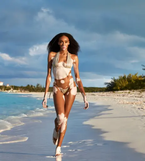 Image 1746669 from Winnie Harlow