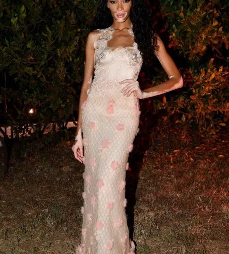 Image 1744578 from Winnie Harlow