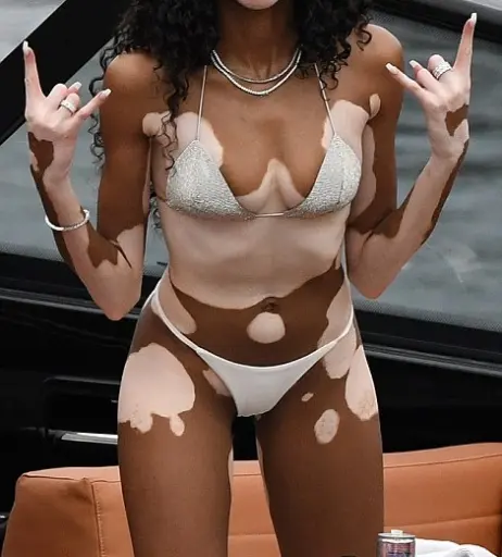 Image 1741796 from Winnie Harlow