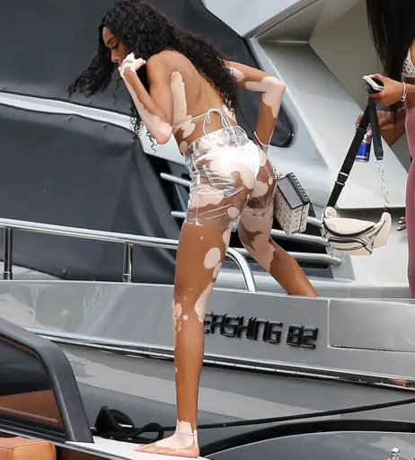 Image 1741783 from Winnie Harlow