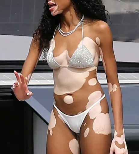 Image 1741741 from Winnie Harlow