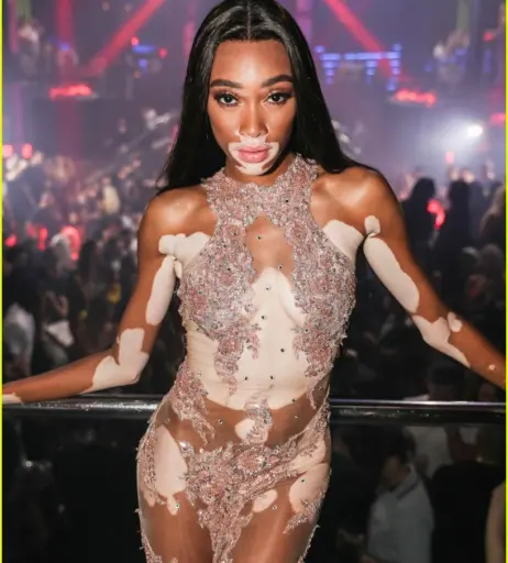 Image 1741715 from Winnie Harlow