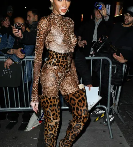 Image 1740635 from Winnie Harlow