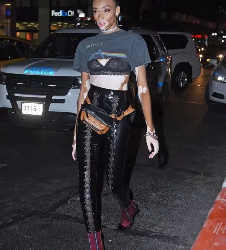 Image 1740358 from Winnie Harlow