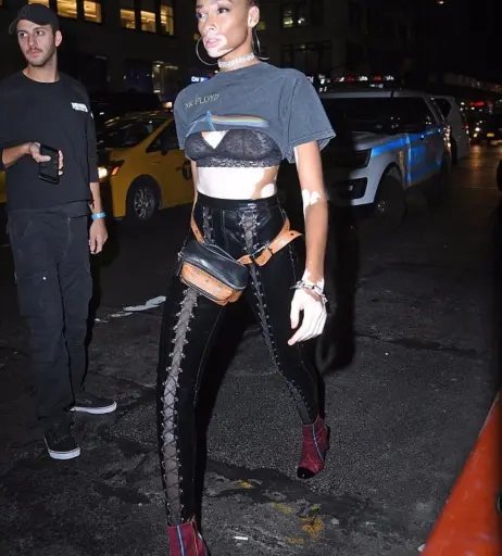 Image 1740303 from Winnie Harlow