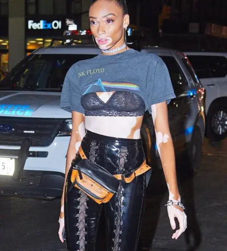 Image 1740336 from Winnie Harlow
