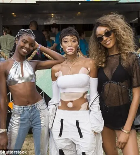 Image 1740285 from Winnie Harlow