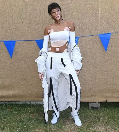 Image 1740228 from Winnie Harlow
