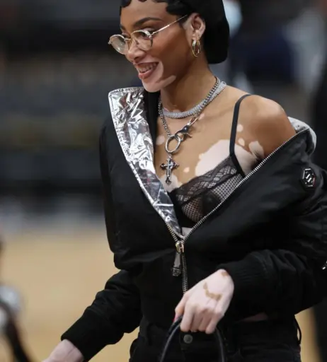 Image 1748636 from Winnie Harlow