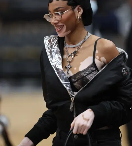 Image 1748236 from Winnie Harlow